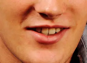 Face and mouth retouched